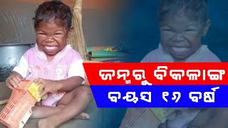 ଜନ୍ମରୁ ଆଜକୁ ପ୍ରାୟ ୧୬ ବର୍ଷ ହେଲା ବିକଳାଙ୍ଗ ଅବସ୍ଥାରେ ପଡ଼ିରହି ଛନ୍ତି। ସରକାରୀ ସହାୟତା ମିଳିପାରୁ ନାହିଁ।