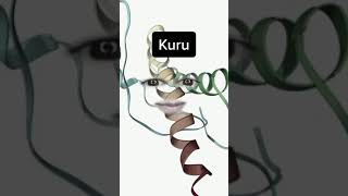 Kuru - Priones