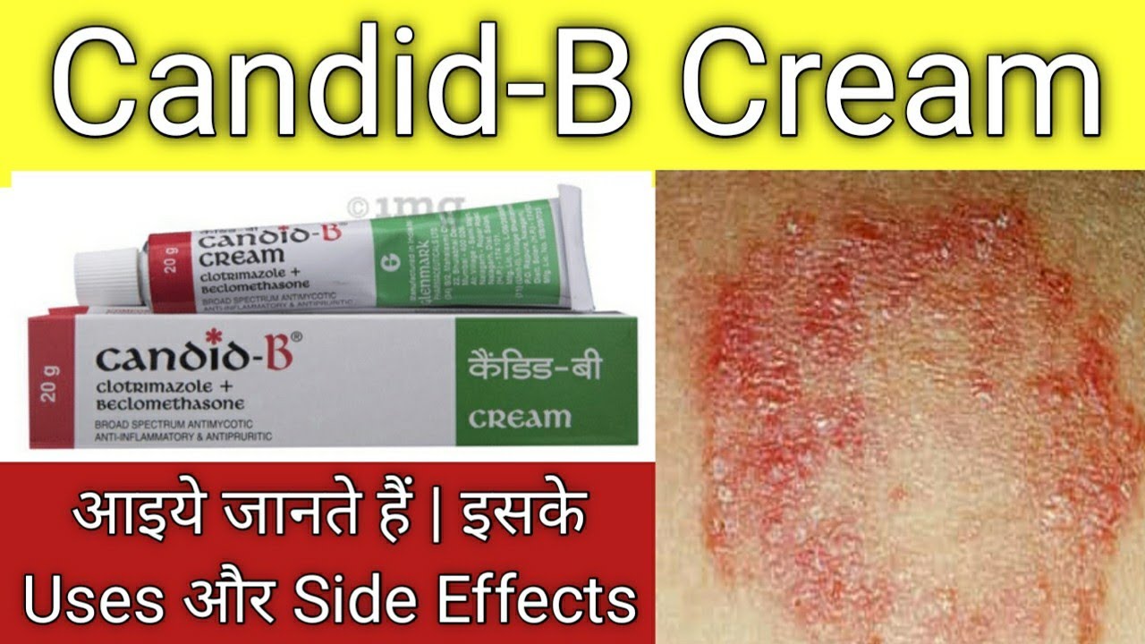 Candid-B Cream Uses And Side Effects/fungal Cream/fungal Infection/skin ...