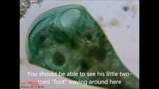 Rotifer swallowed by and moving inside Stentor