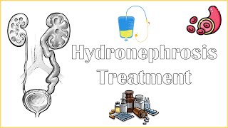 Hydronephrosis Treatment - Medical & Surgical Management Of Hydronephrosis
