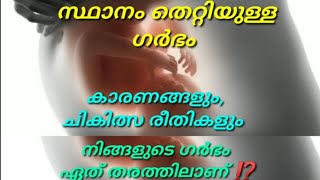 നിങ്ങളുടെ ഗർഭം ഏത് തരത്തിലാണ് ⁉️