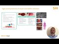 i of t.i.m.e. infection inflammation module 10 – revalidation cpd course wound club online