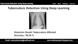 Tuberculosis Detection Using Deep Learning | Tuberculosis Detection Using Python Project Code