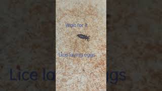Lice removal | live lice egg laying | gross 🤢 | subscribe for more