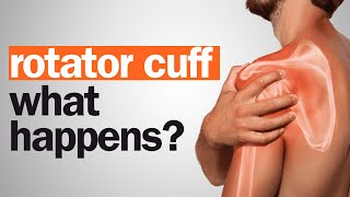 What happens if you wait too long to have rotator cuff surgery?