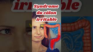 Causes: côlon irritable Syndrome intestin Nerveux colopathie Fonctionnelle #colonirritable #colon