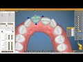 03 tooth movement features 操作功能介紹 左邊欄位旋轉、平移