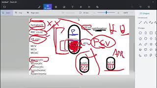 صورة الدم كاملة مع دكتور / أحمد عصام.(CBC)تعلم قراءة و تشخيص تحليل