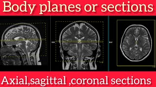 Body planes or sections in hindi II Radioloy II axial II coronal II sagittal II oblique planes