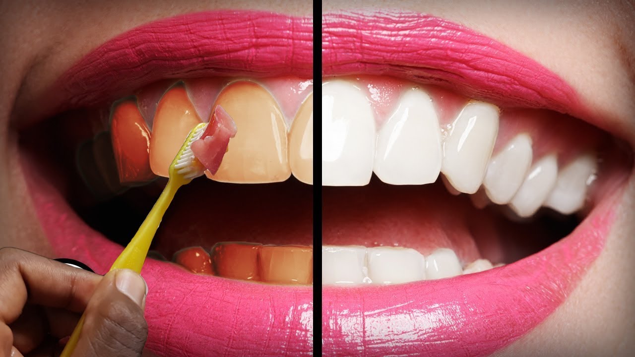 IN JUST 2 MINUTES, TURN YELLOW TEETH TO WHITE NATURALLY | TEETH ...