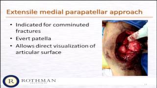 Difficult patella fractures - how to improve your results