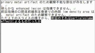 歯科放射線科読影レポート用「AmiVoice Ex7 DentRad」