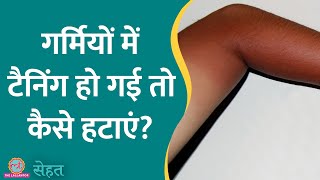 Summer में Skin Tanning क्यों होती है और उसे कैसे ठीक करें, जानिए डॉ. से | Sehat ep 867