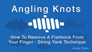How To Remove A Fishhook From Your Finger : String Yank Technique