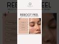 REBOOT PEEL | SKIN CLINIC IN DUBAI | ALKALINE FACIAL #Dubai #dubaibeauty #skintreatment #kbeauty