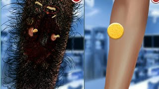 ASMR maggot infected leg, remove dog ticks & pustules - deep cleaning animation#asmr