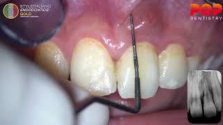 Habib - Intra Oral Examination