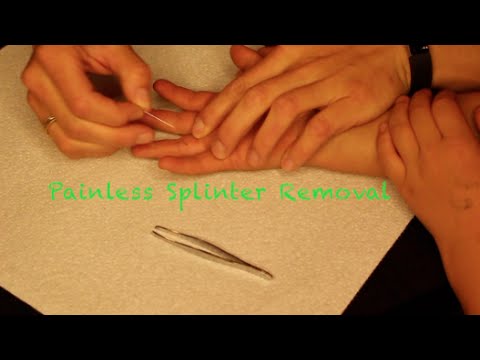 How To: Painless Splinter Removal! How To: Painless Splinter Removal!