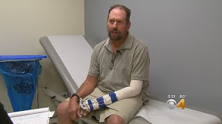 Man's Leg Helps Save Injured Arm