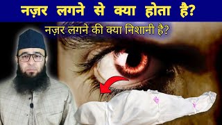 नज़र लगने की क्या निशानी है | Nazar lagne se kya hota hai? evil eye 👁‍🗨 symptoms