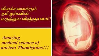 Amazing Medical science of ancient Thamizhans | வியக்க வைக்கும் தமிழர்களின் மருத்துவ அறிவு!!