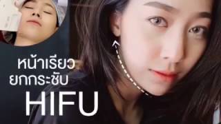 รีวิว HIFU ยกหน้าวีเชฟ เห็นผลทันที ที่ Aya clinic