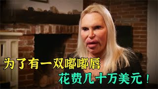 【野兽beast】 他为了拥有一双嘟嘟唇，不惜花费百万，看过本人吓坏我了