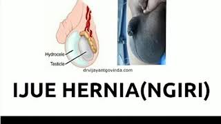 *IJUE HERNIA (NGIRI) NI CHANZO KIKUBWA CHA UKOSEFU WA NGUVU ZA KIUME DR SHOGORO +255716426906