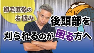 【男性必見！】シートウィッグをつけたら後頭部を隠せます