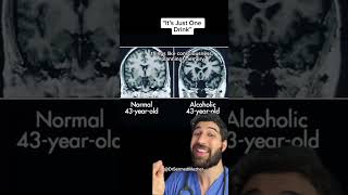 It S Just One Drink Brain