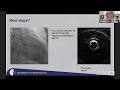 live scai bifurcation club in stent restenosis