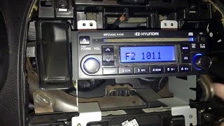 Hyundai Elantra 2010 Radio Lights On But Won't Work Fix