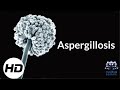 Aspergillosis: Everything You Need To Know