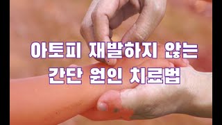 아토피 간단 근원 해법#아토피원인#아토피증상#가려움증