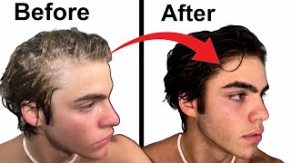 How To Stop Balding |  hair loss guide