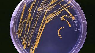 Predictive microbiology | Wikipedia audio article