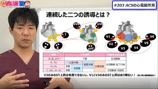 見るべきポイントはST部分だけではありません、異常Q波と、●波も大事ですねぇ・・・。