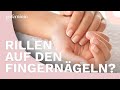 Rillen in den Fingernägeln: Was haben sie zu bedeuten und was kann man dagegen tun?