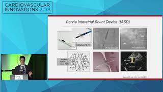 CVI2018 Session: Interatrial shunt therapy - Scott Lilly, MD