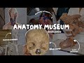 anatomy museum tour 🏨☠️|gach patna #bams #mbbs #anatomy #medico #vlog