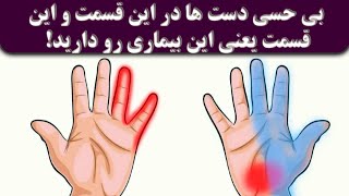 بی حسی دست ها این مشکلات را در بدن به ما هشدار می دهد!