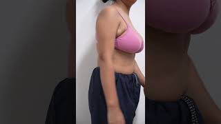 Axillary Fat Removal | Axillary Fat | Axillary Fat Video #shortvideo #cosmeticsurgery