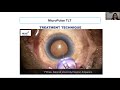 The Evolution and Versatility of MicroPulse TLT for Glaucoma: Experiences in Asia Pacific