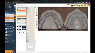 SmileStream Model calibration