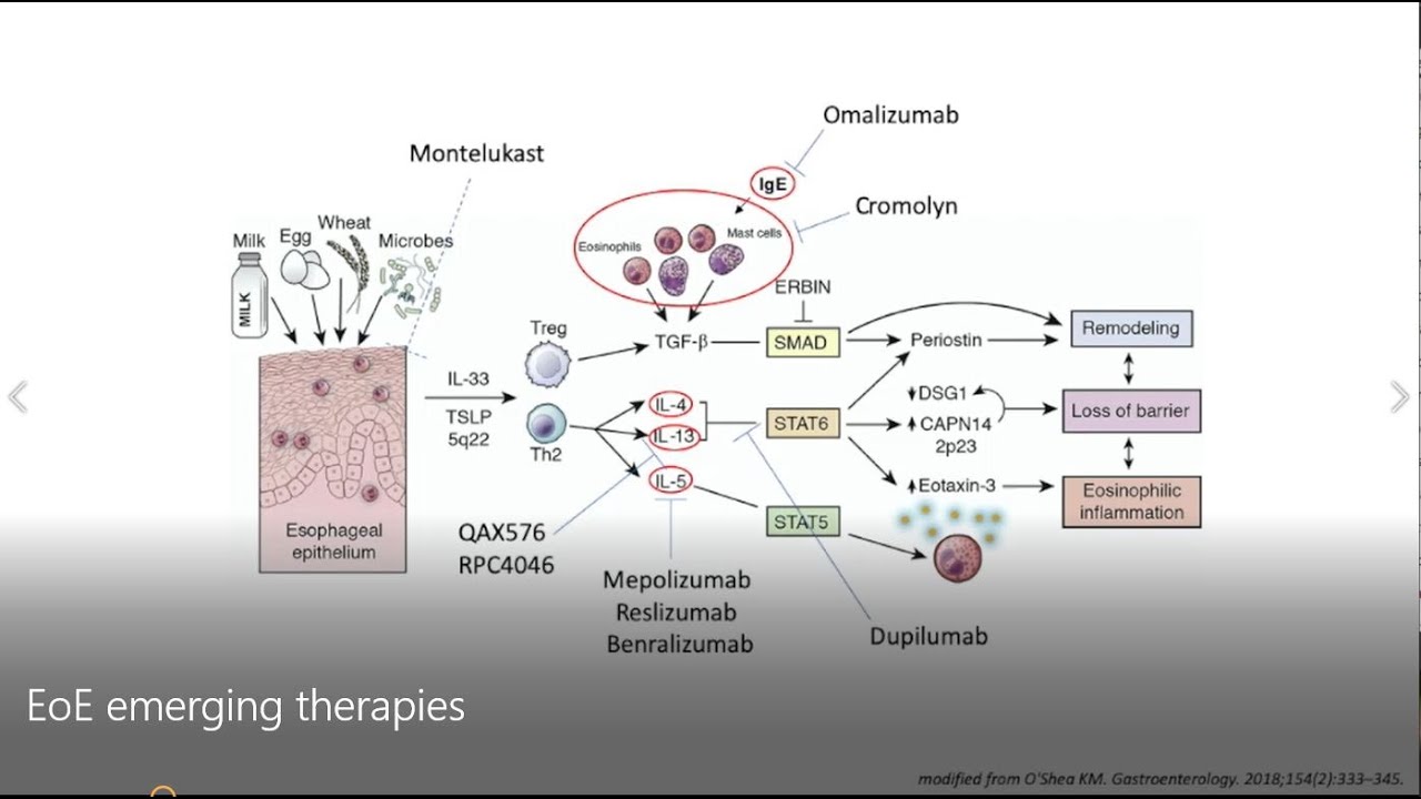 Mechanisms Of Eosinophilic Esophagitis Conventional