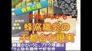 蜂窩織炎とは【肩甲骨はがしで評判、横浜・菊名の整体院一宇～ITIU～】