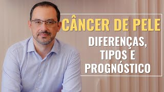 ✅ CÂNCER DE PELE - DIFERENÇAS E TIPOS | **ATENÇÃO**: um dos tipos é o câncer mais frequente do mundo