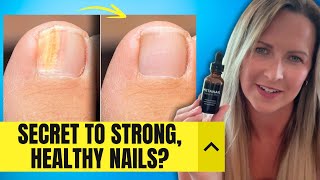 Metanail Serum Pro Review: Secret to Healthy Nails? (BEWARE!!)