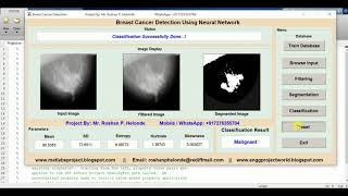 Matlab Code for Breast Cancer Detection Using Neural Network